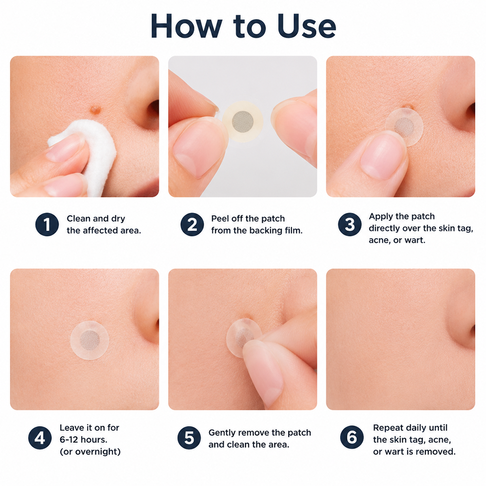 Virexo™ 2-in-1 Microneedle & Hydrocolloid Patch👨‍⚕️ | Removes raised moles, acne, flat warts, and skin tags | Helps improve wrinkles, scars, and blemishes | Invisible patches for face and body💖