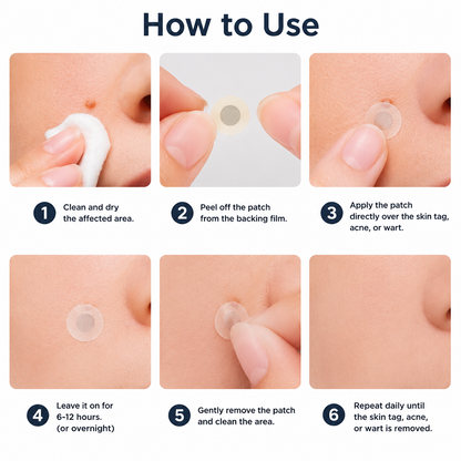 Virexo™ 2-in-1 Microneedle & Hydrocolloid Patch👨‍⚕️ | Removes raised moles, acne, flat warts, and skin tags | Helps improve wrinkles, scars, and blemishes | Invisible patches for face and body💖
